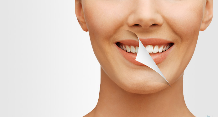 Teeth Whitening Concept